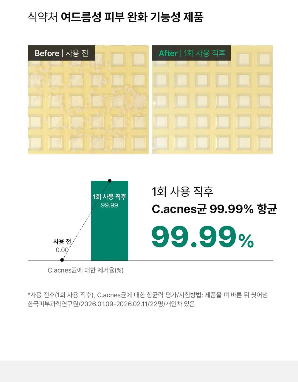 [단독기획] 동아제약 아크네 프로 겔제 30ml 기획(+3ml+크림제3ml) 상세페이지 10